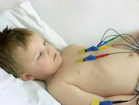 Elektroterapia serca u dzieci i dorosłych – kluczowe różnice i wyzwania