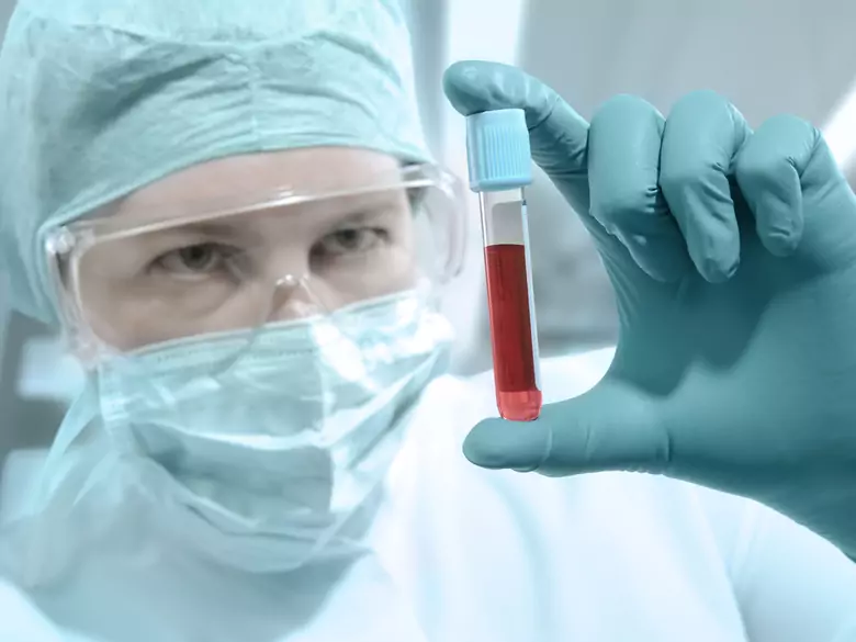 1 grudnia – Światowy Dzień AIDS